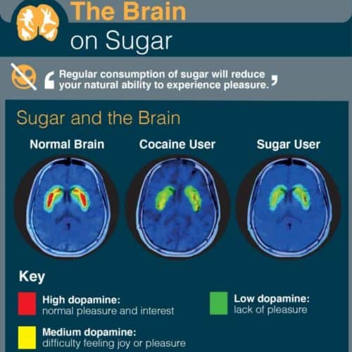 The Brain on Sugar